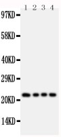 FGF22 antibody