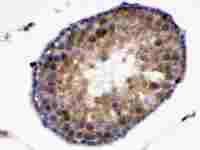 Kallikrein 5 antibody