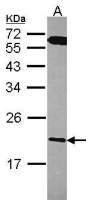RGS10 antibody