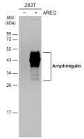 Amphiregulin antibody