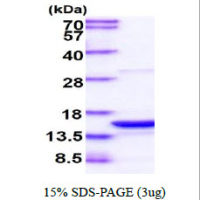 Human PDCD5 protein