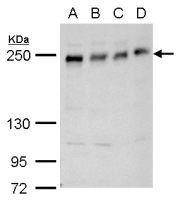 ANKRD26 antibody