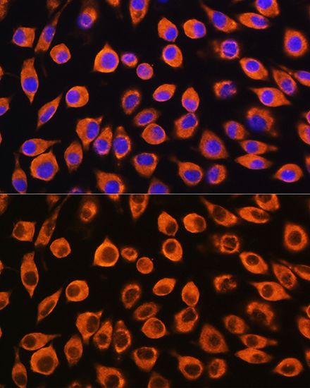 IL23 Receptor antibody
