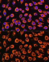 IL23 Receptor antibody