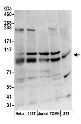 SERCA2 ATPase antibody