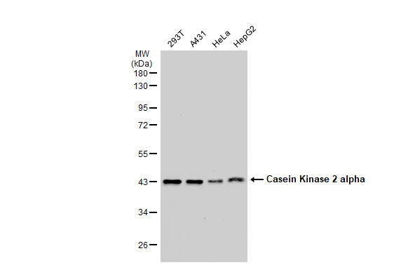 Casein Kinase 2 alpha antibody [GT1233]