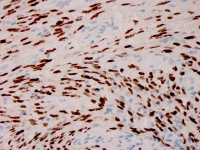KSHV ORF73 antibody [HHV8/3606]
