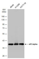 eIF2 alpha antibody [N1C3]