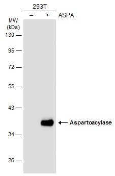 Aspartoacylase antibody