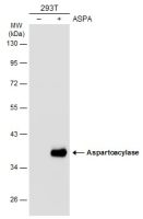 Aspartoacylase antibody