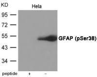 GFAP (phospho Ser38) antibody