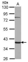 ZNF302 antibody