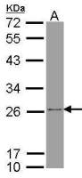 ATP synthase B1 antibody