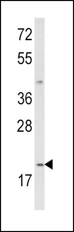 IL12A / IL12 p35 antibody, C-term