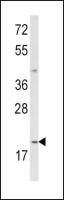 IL12A / IL12 p35 antibody, C-term