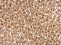 APLP2 antibody [N1N2], N-term