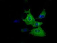 Tristetraprolin antibody [3D10]