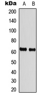 Chk2 (phospho Thr68) antibody