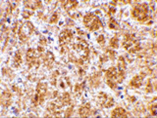 DARC antibody