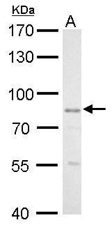 GLIS3 antibody