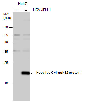 Hepatitis C virus NS2 protein antibody
