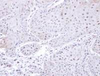 PSMC3 antibody [N1C2]