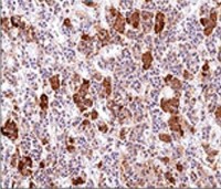 ACTH antibody [AH26]
