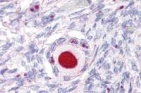 Steroidogenic Factor 1 antibody