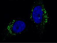 Cathepsin A antibody [104]
