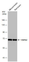 HSPA2 antibody [C1C3]