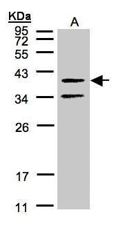 GALR2 antibody
