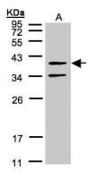 GALR2 antibody