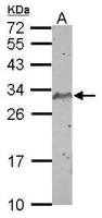 SCP3 antibody