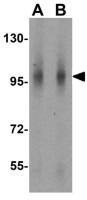 NOD2 antibody