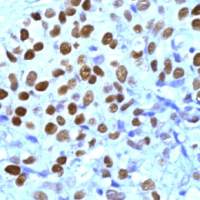 Progesterone Receptor antibody (ready-to-use)