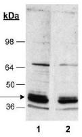 Sodium/Potassium ATPase beta 1 antibody [464.8(8A)]