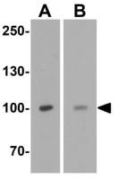 TRPV4 antibody
