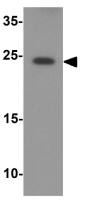 ARHI antibody