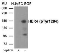 Her4 / ErbB4 (phospho Tyr1284) antibody