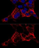 Cytokeratin 20 antibody