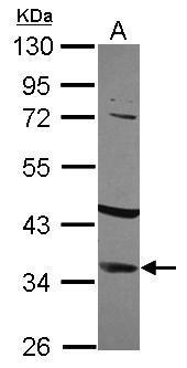 IGFBP2 antibody