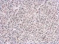 CENPF antibody [14C10 1D8]