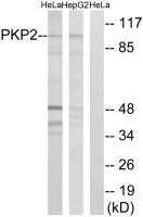 PKP2 antibody