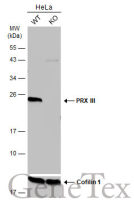 PRX III antibody [N1C3]