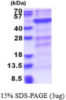 Human DNMT3L protein, His tag