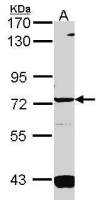 GUCY1A3 antibody [C1C3]