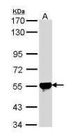 ALDH2 antibody [N1C1]