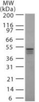 IKK gamma antibody [46B844]