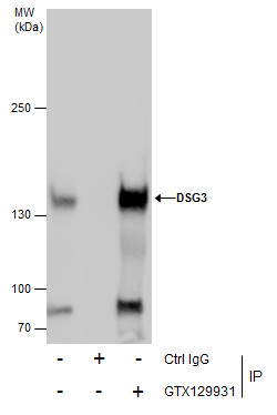 Desmoglein 3 antibody