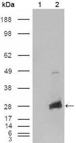 alpha B Crystallin antibody [1D11C6E6]